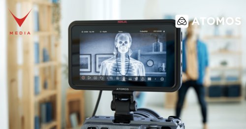 Atomos-x-ray